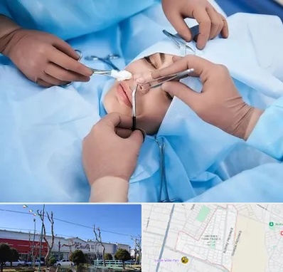 عمل بینی فانتزی در فاز دو اندیشه
