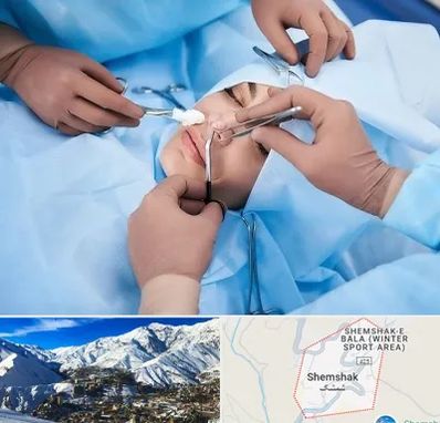 عمل بینی فانتزی در شمشک
