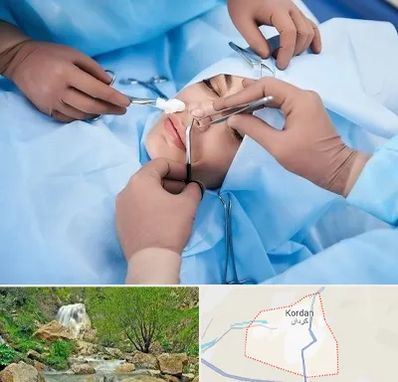 عمل بینی فانتزی در کردان