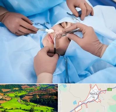 عمل بینی فانتزی در نکا