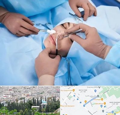 عمل بینی فانتزی در محلاتی شیراز