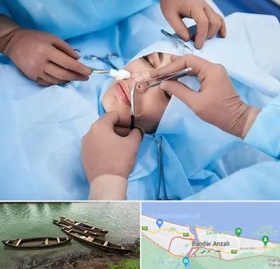 عمل بینی فانتزی در بندر انزلی