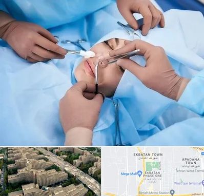 عمل بینی فانتزی در اکباتان 