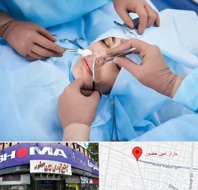 عمل بینی فانتزی در امین حضور