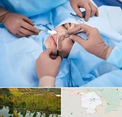 عمل بینی فانتزی در بهبهان