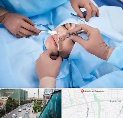 عمل بینی فانتزی در بلوار فرحزادی