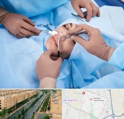 عمل بینی فانتزی در فاز سه اندیشه