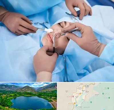 عمل بینی فانتزی در رودبار