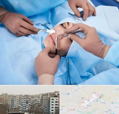 عمل بینی فانتزی در محمد شهر کرج