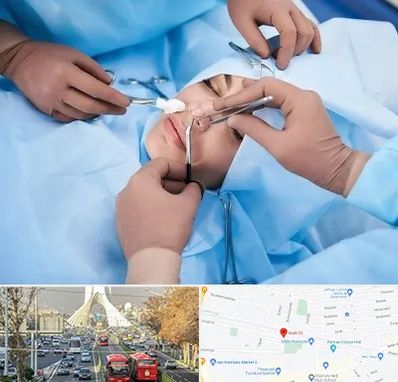 عمل بینی فانتزی در خیابان آزادی 