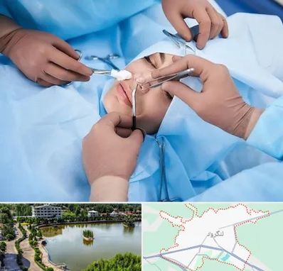 عمل بینی فانتزی در لنگرود