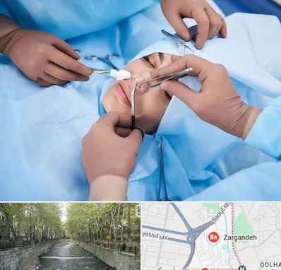 عمل بینی فانتزی در زرگنده