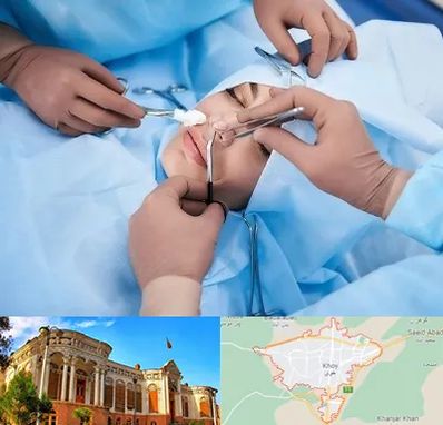 عمل بینی فانتزی در خوی