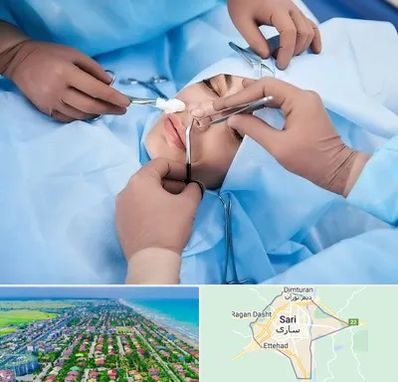 عمل بینی فانتزی در ساری