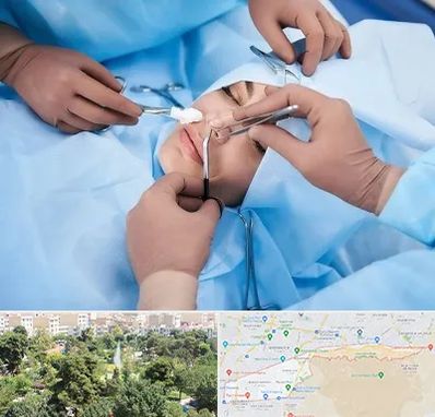 عمل بینی فانتزی در منطقه 13 تهران 