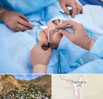 عمل بینی فانتزی در فشم