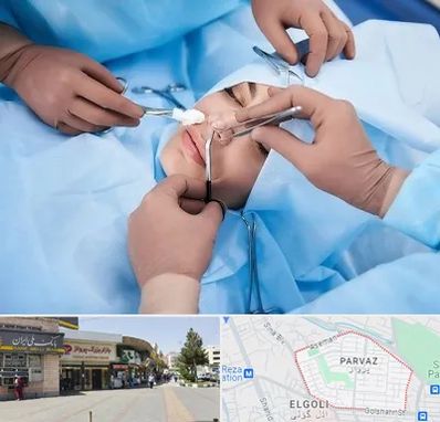 عمل بینی فانتزی در پرواز تبریز