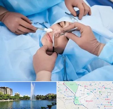 عمل بینی فانتزی در کوهسنگی مشهد