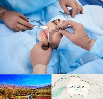 عمل بینی فانتزی در خراسان شمالی