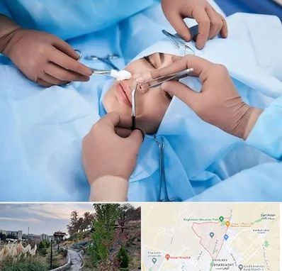 عمل بینی فانتزی در باغستان کرج