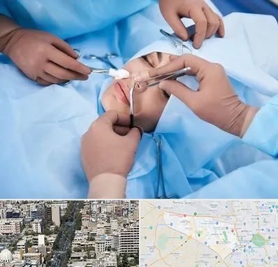 عمل بینی فانتزی در منطقه 18 تهران 