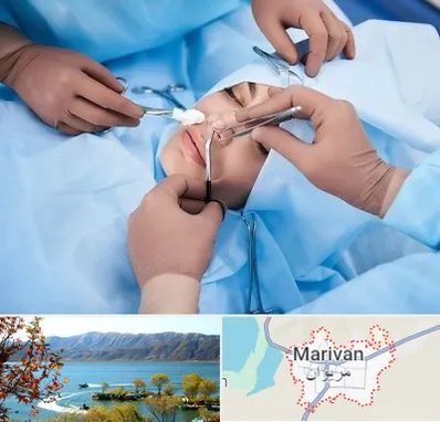 عمل بینی فانتزی در مریوان