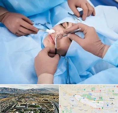 عمل بینی فانتزی در منطقه 21 تهران 