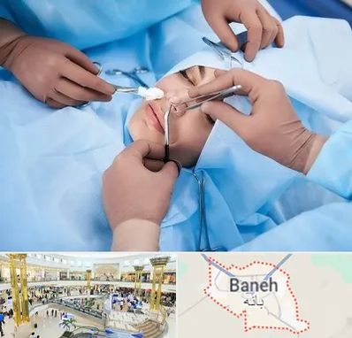عمل بینی فانتزی در بانه