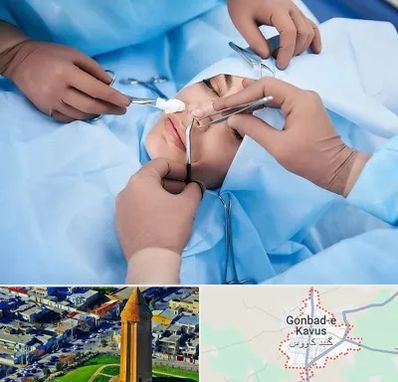 عمل بینی فانتزی در گنبد کاووس