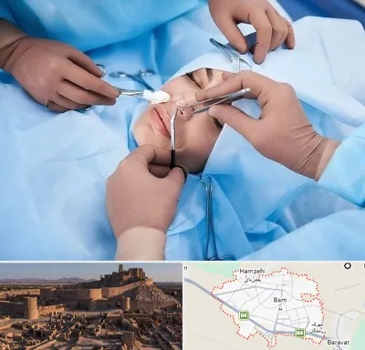عمل بینی فانتزی در بم