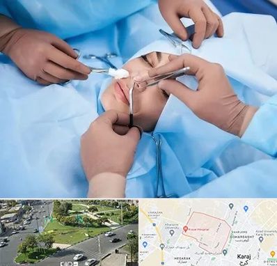 عمل بینی فانتزی در شاهین ویلا کرج