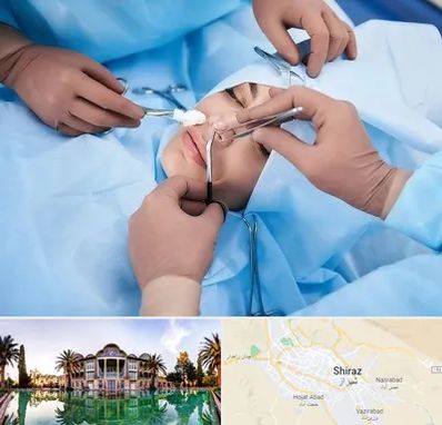 عمل بینی فانتزی در شیراز