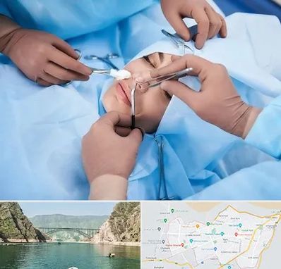 عمل بینی فانتزی در ایلام