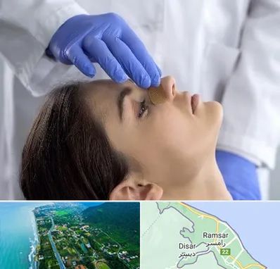 عمل بینی عروسکی در رامسر