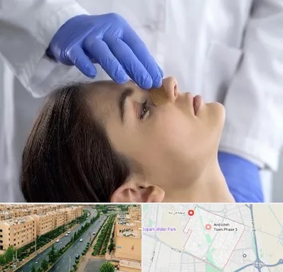 عمل بینی عروسکی در فاز سه اندیشه