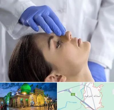 عمل بینی عروسکی در آستانه اشرفیه
