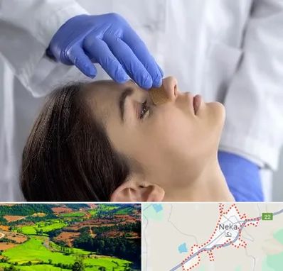 عمل بینی عروسکی در نکا