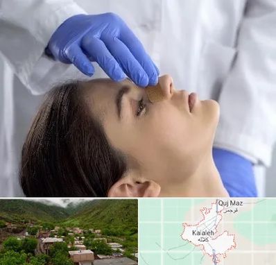 عمل بینی عروسکی در کلاله