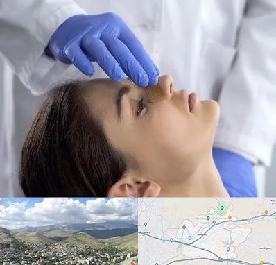 عمل بینی عروسکی در رودهن