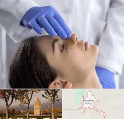 عمل بینی عروسکی در تویسرکان