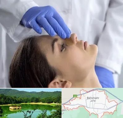 عمل بینی عروسکی در بهشهر