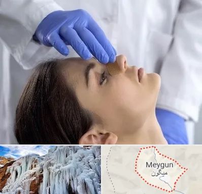 عمل بینی عروسکی در میگون
