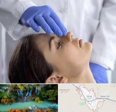 عمل بینی عروسکی در دورود