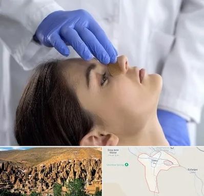 عمل بینی عروسکی در اسکو