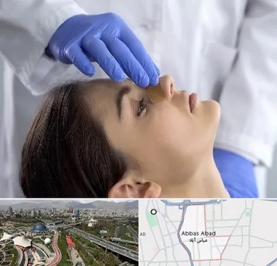 عمل بینی عروسکی در عباس آباد تهران