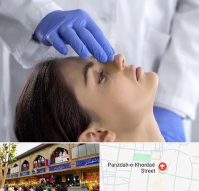 عمل بینی عروسکی در 15 خرداد