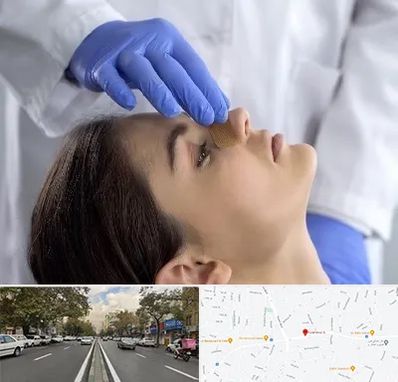 عمل بینی عروسکی در دولت