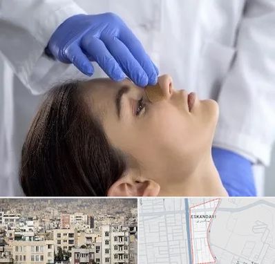 عمل بینی عروسکی در اسکندری