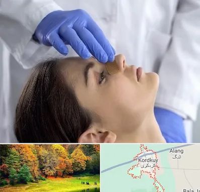عمل بینی عروسکی در کردکوی