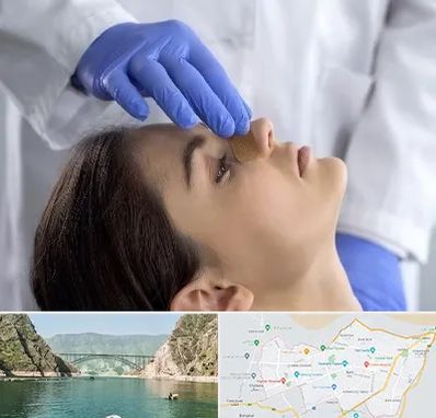 عمل بینی عروسکی در ایلام